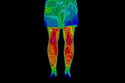 Thermal control condition image