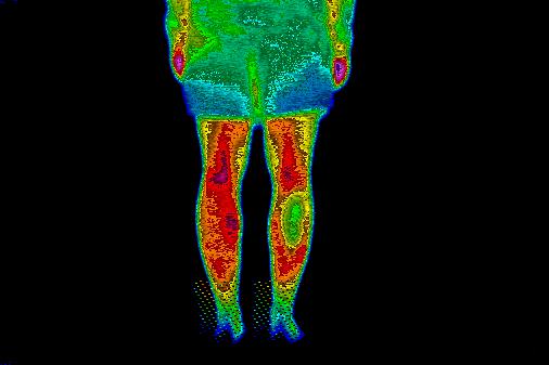 Thermal image immediately after ice intervention