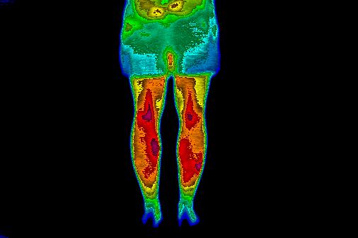 Thermal image at 15-minute recovery interval