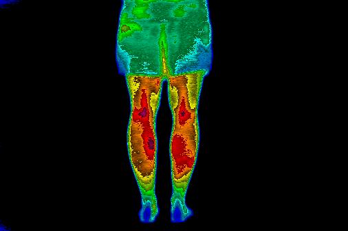 Thermal image showing 30-minute ice recovery condition